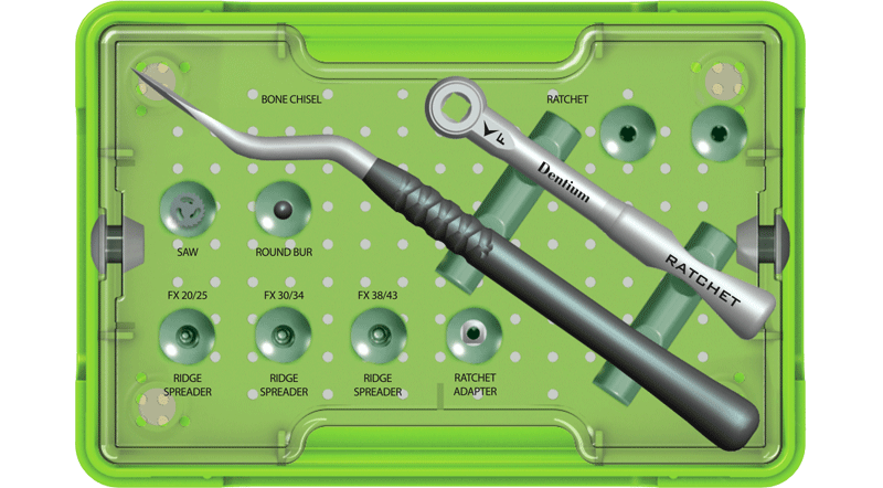 RS Kit (Ridge Spreader Kit)